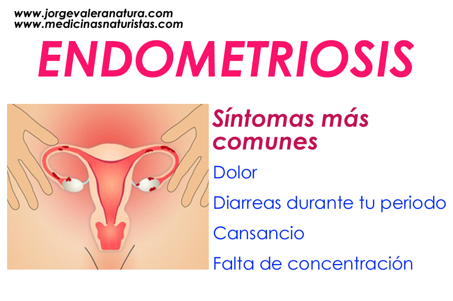 endometriosis-sos